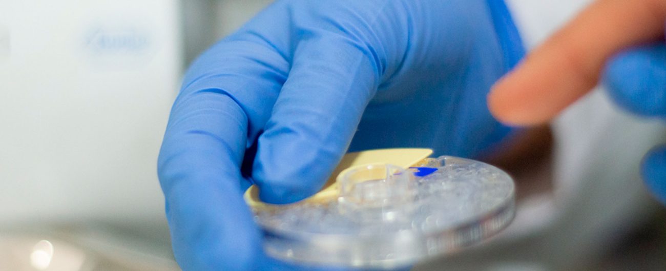 analítica colesterol i glucosa Granollers