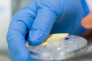 analítica colesterol i glucosa Granollers