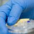 analítica colesterol i glucosa Granollers